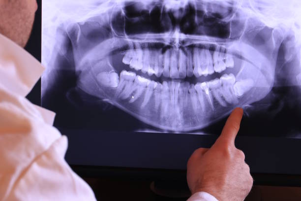 Best Emergency Treatment for Dental Infections or Abscesses in Sharpsburg, NC