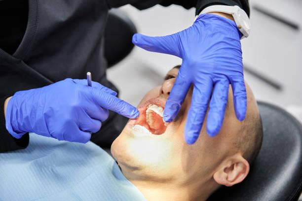 Best Emergency Gum Treatment in Sharpsburg, NC